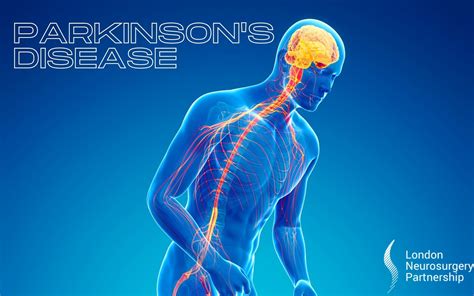 parkinson or parkinson's disease